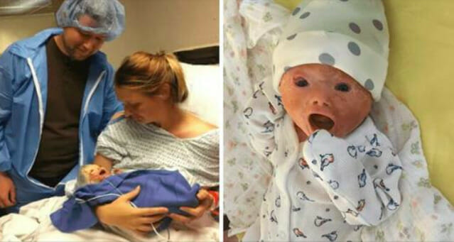 Doctors forced to do emergency caesarean section – dad sees baby’s face and room falls silent