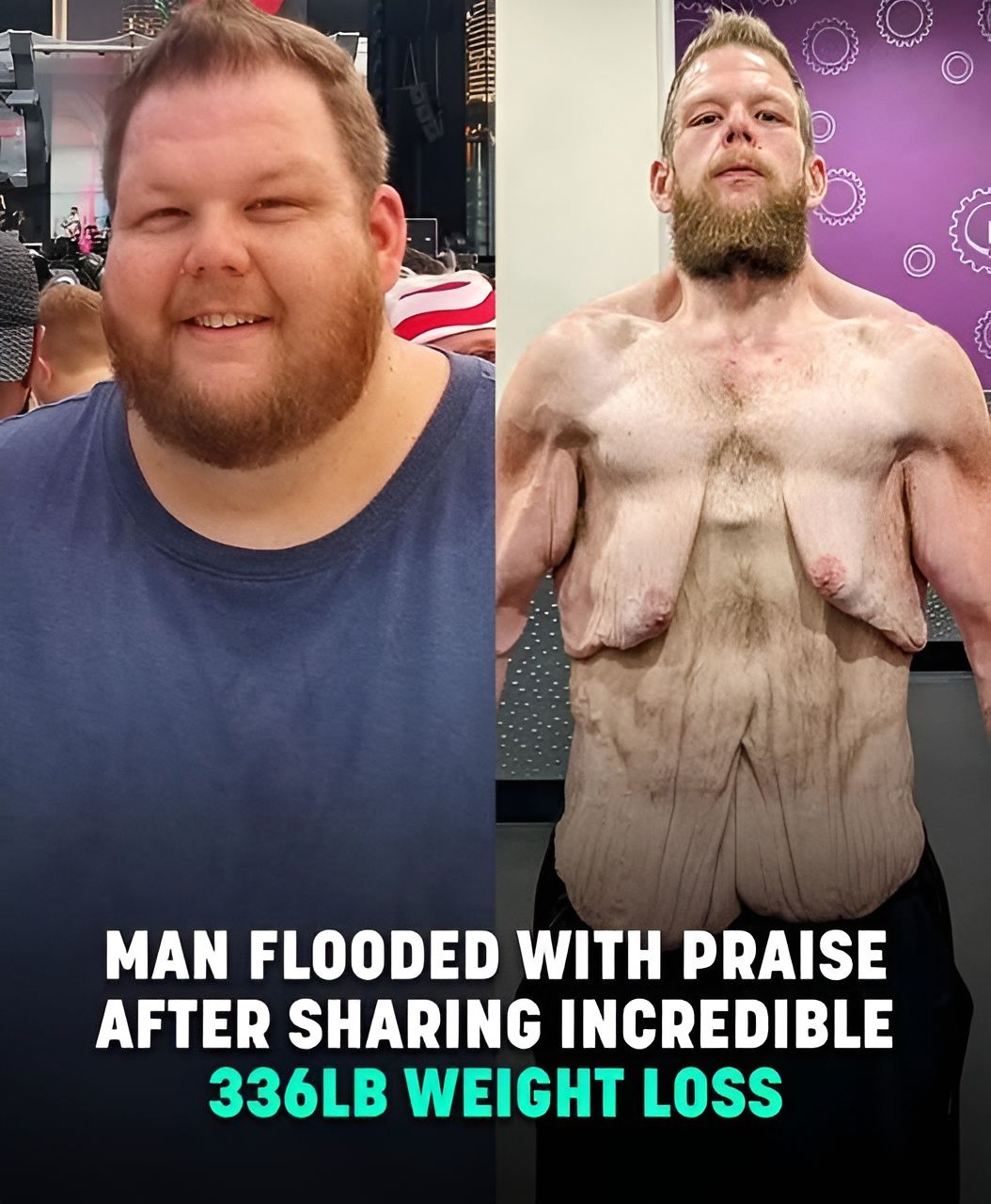 Internet praises man for 360lb weight loss