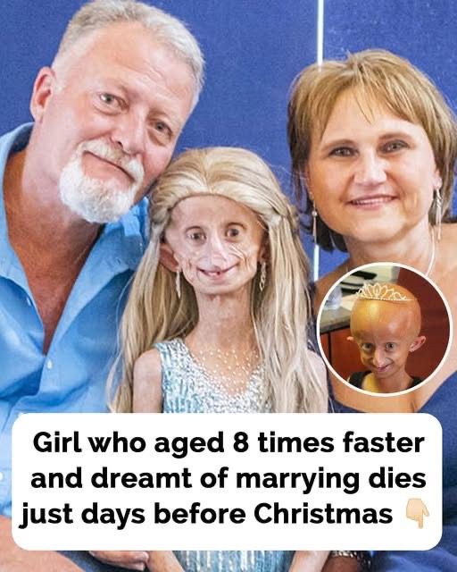 Beandri Booysen, Girl In South Africa With Progeria Dies