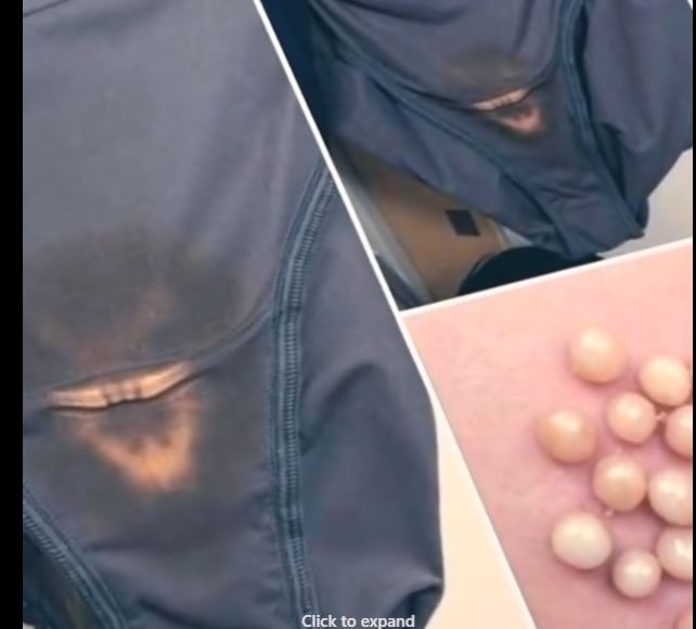 BE CAREFUL, if you notice this in your underwear, it means you have!!